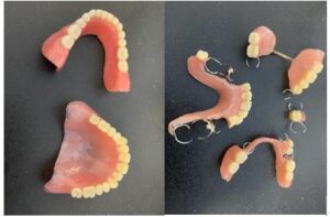 第20回「入れ歯の口腔ケア」 - 介護用品のピジョンタヒラ